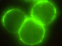 Bilde av antistoffer som binder seg til kreftceller