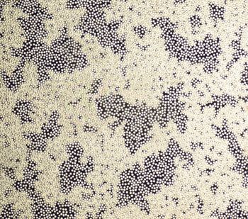 Detail of a Capillary Fingering pattern that arises when air is slowly injected in a liquid-filled porous network. The diameter of the glass beads is around 1mm.