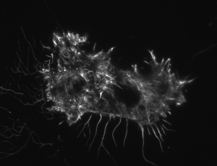 HeLa cell TIRF image