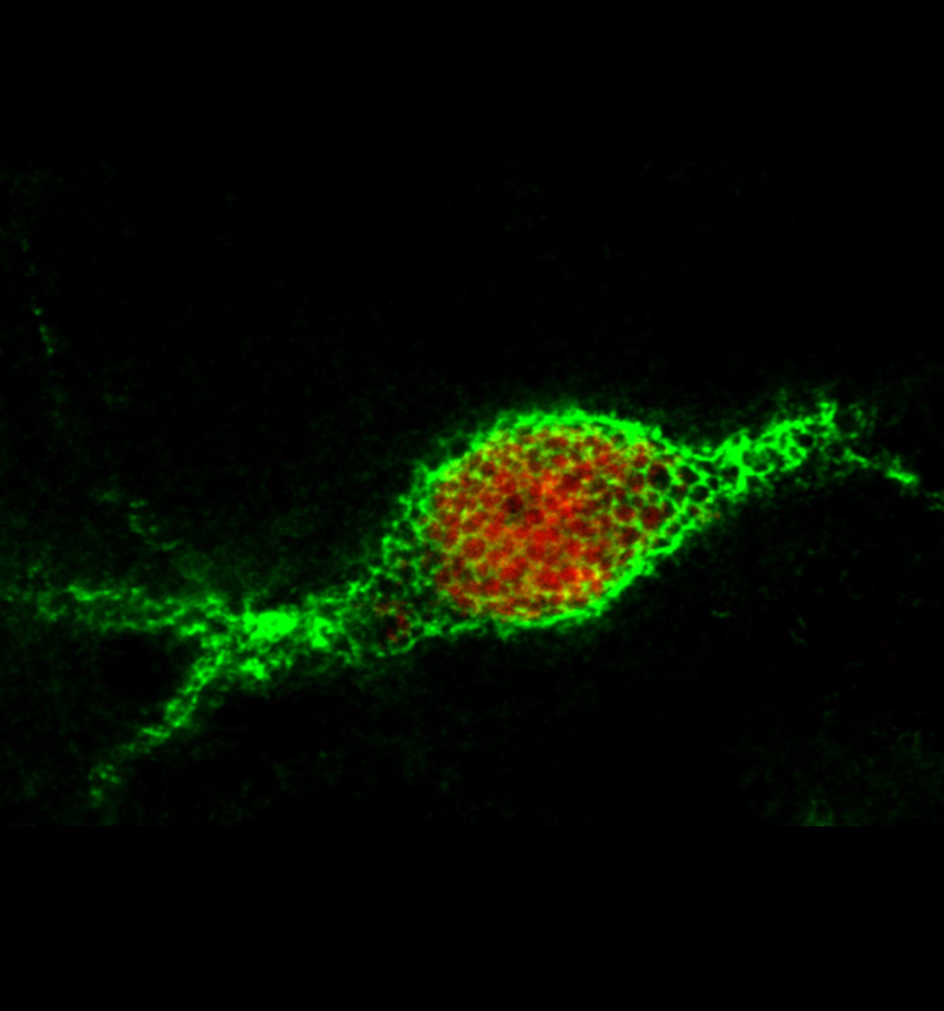 Perineuronal net in green wrapped around a neuron in red