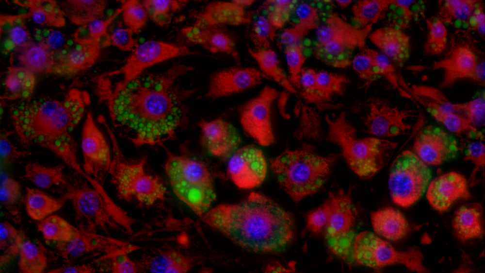 3T3-L1 cells after differentiation into adipocyte - Green: Lipid droplets; Red: Mitochondria; Blue: Nuclei.