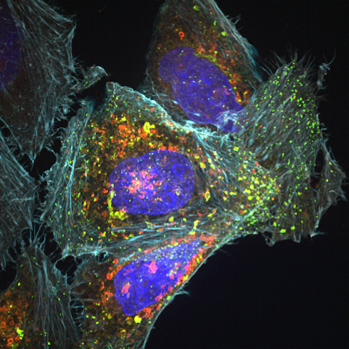 Microscope photo of cells