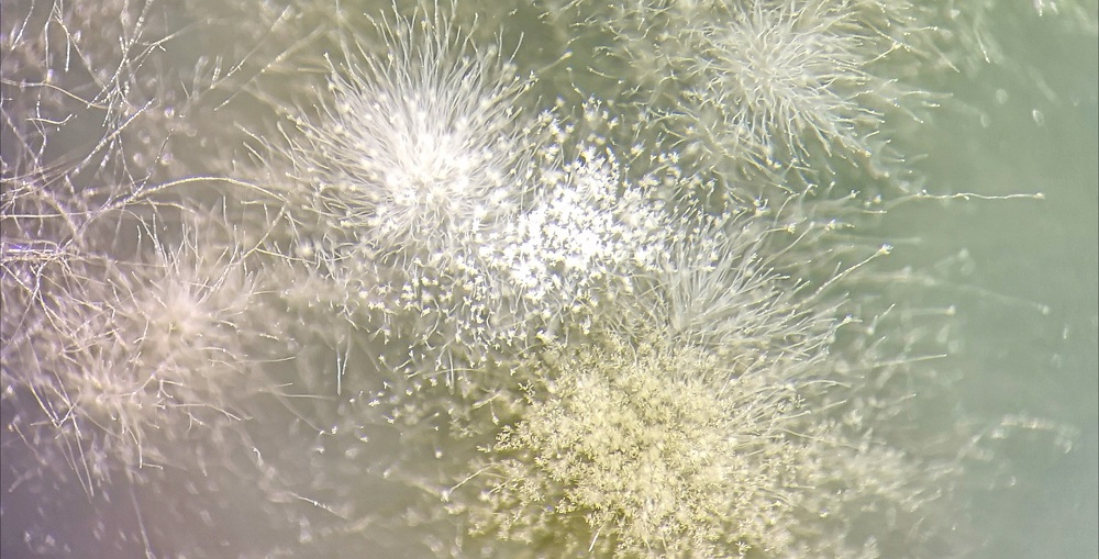 Muggsporer fra sopp i mikroskopet