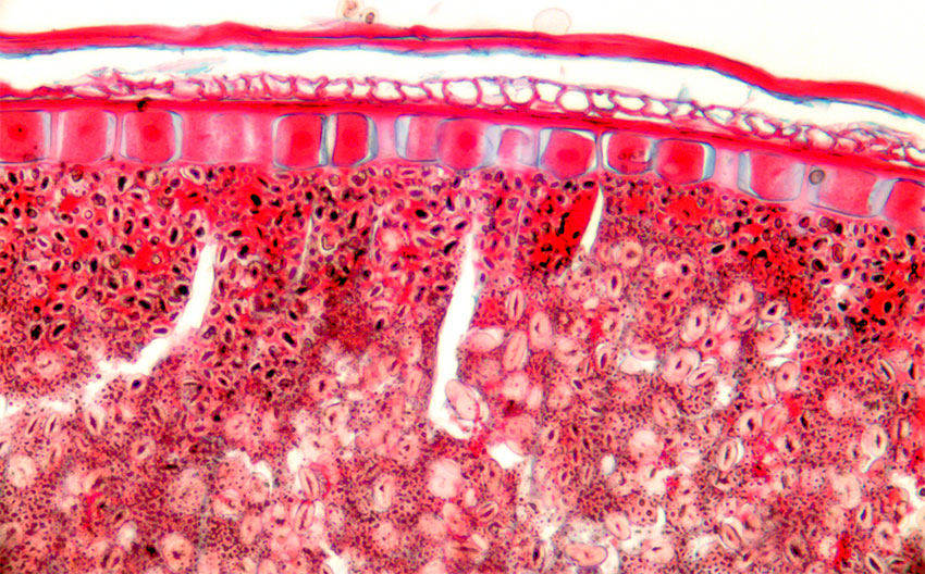Farget mikroskopisnitt fra hvetekorn.