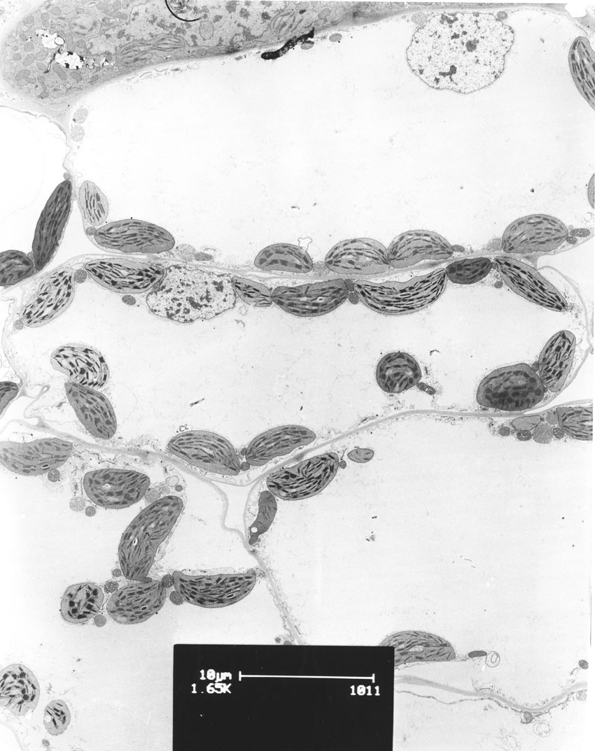Celle fra blad erter som viser kloroplaster