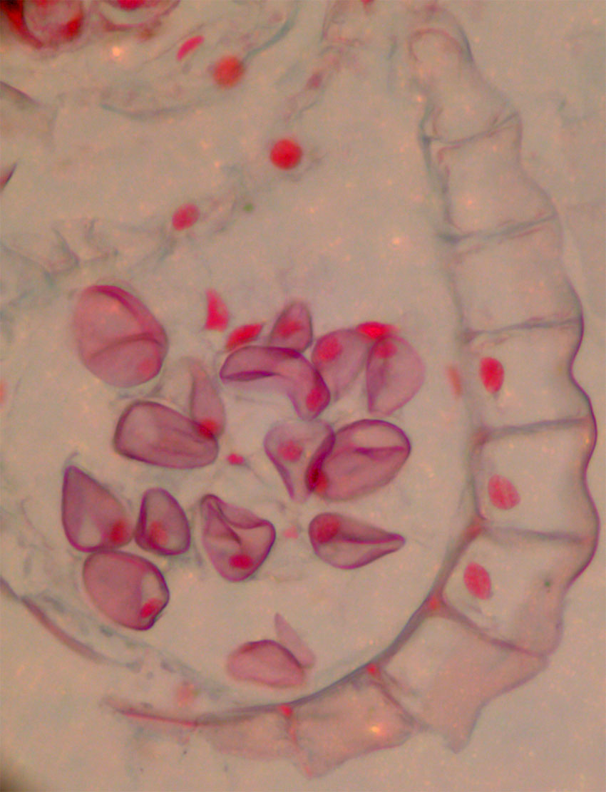 Polypodium sporgangium med sporer