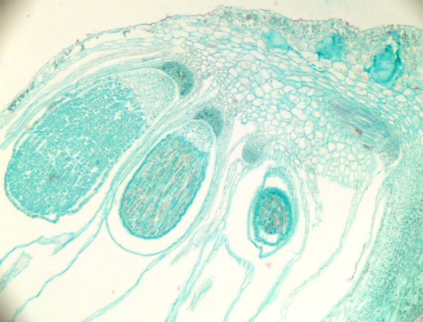 Marchantia tverrsnitt hunntvare