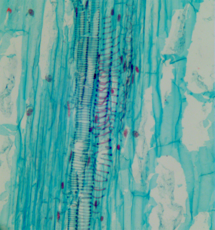 Tulipan lengdesnitt stengel