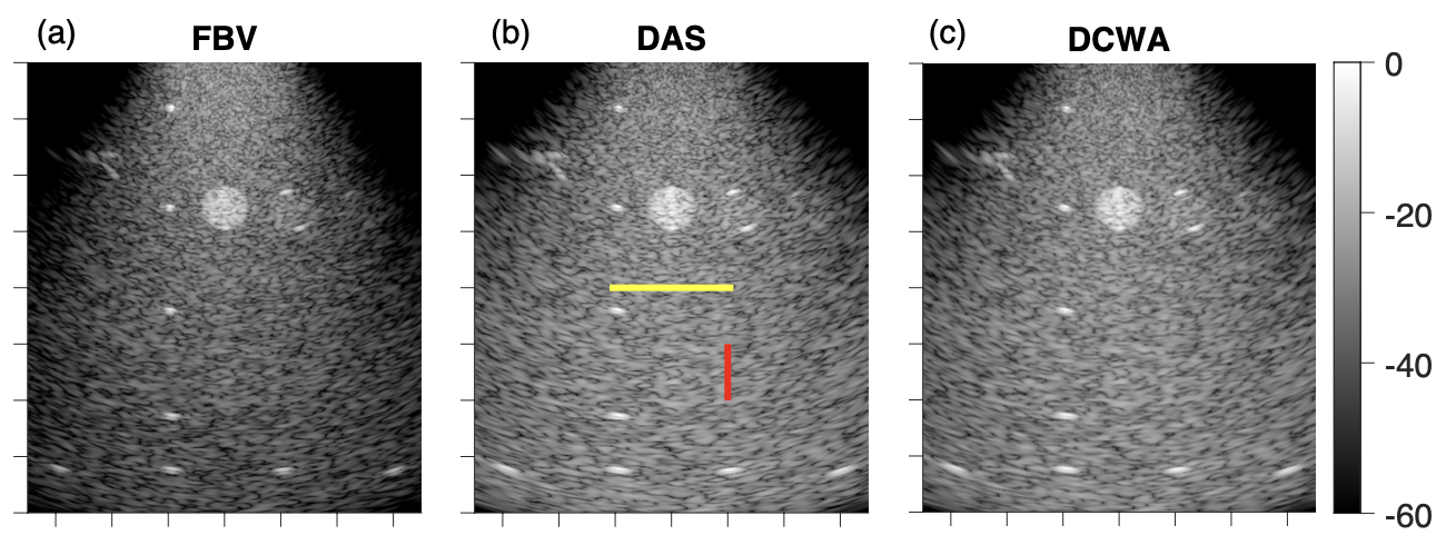 The rightmost DCWA panel demonstrates that our algorithm provides the same image reconstruction output as delay-and-sum – however this happens at a radically reduced computational burden.