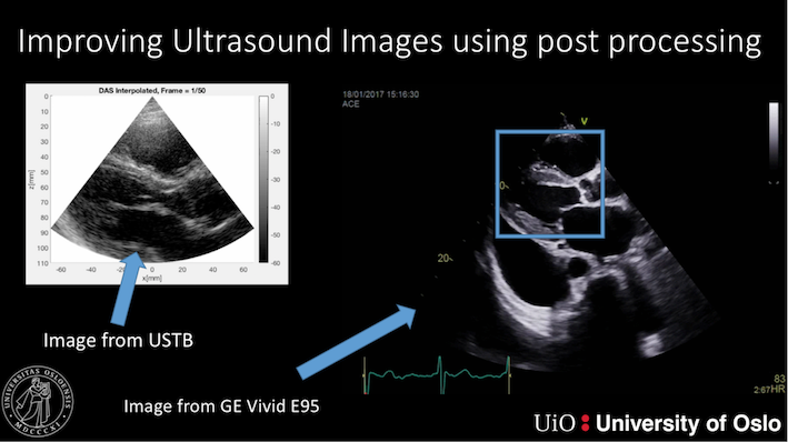 Bildet kan inneholde: medisinsk avbildning, obstetrisk ultrasonografi, radiologi, medisinsk, ledd.