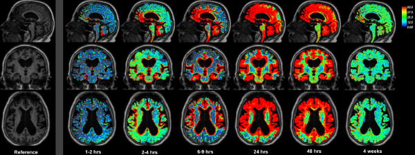 Image may contain: Brain, Organism, Organ, Brain, Rock.
