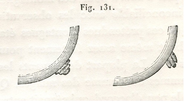 Protuberanser